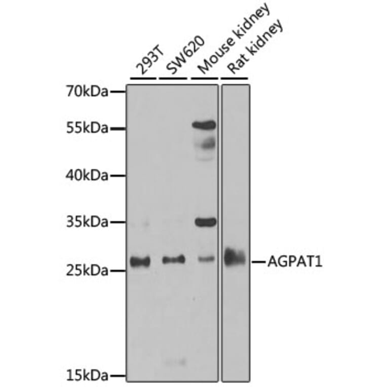 Western Blot - Anti-AGPAT1 Antibody (A9899) - Antibodies.com