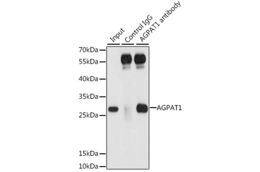 Western Blot - Anti-AGPAT1 Antibody (A9899) - Antibodies.com