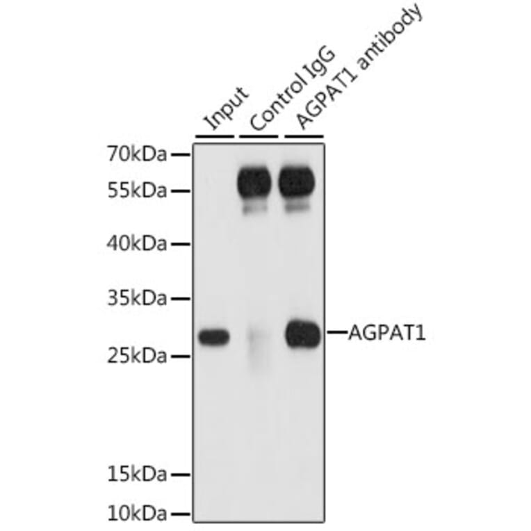 Western Blot - Anti-AGPAT1 Antibody (A9899) - Antibodies.com