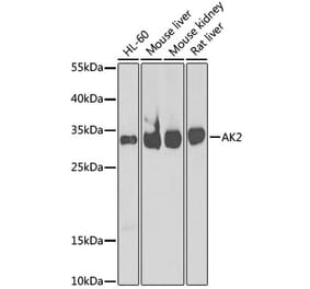 Western Blot - Anti-AK2 Antibody (A9900) - Antibodies.com
