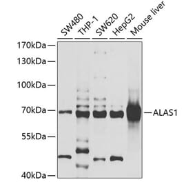 Western Blot - Anti-Alas1 Antibody (A9901) - Antibodies.com