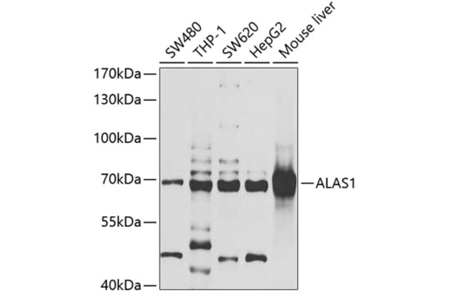 Western Blot - Anti-Alas1 Antibody (A9901) - Antibodies.com