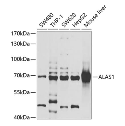 Western Blot - Anti-Alas1 Antibody (A9901) - Antibodies.com