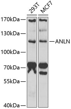 Western blot analysis of extracts of various cell lines, using Anti-ANLN Antibody (A6524) at 1:1,000 dilution.
Secondary antibody: Goat Anti-Rabbit IgG (H+L) (HRP) (AS014) at 1:10,000 dilution.
Lysates / proteins: 25µg per lane.
Blocking buffer: 3% non-fat dry milk in TBST.
Detection: ECL Basic Kit (RM00020).
Exposure time: 90s.