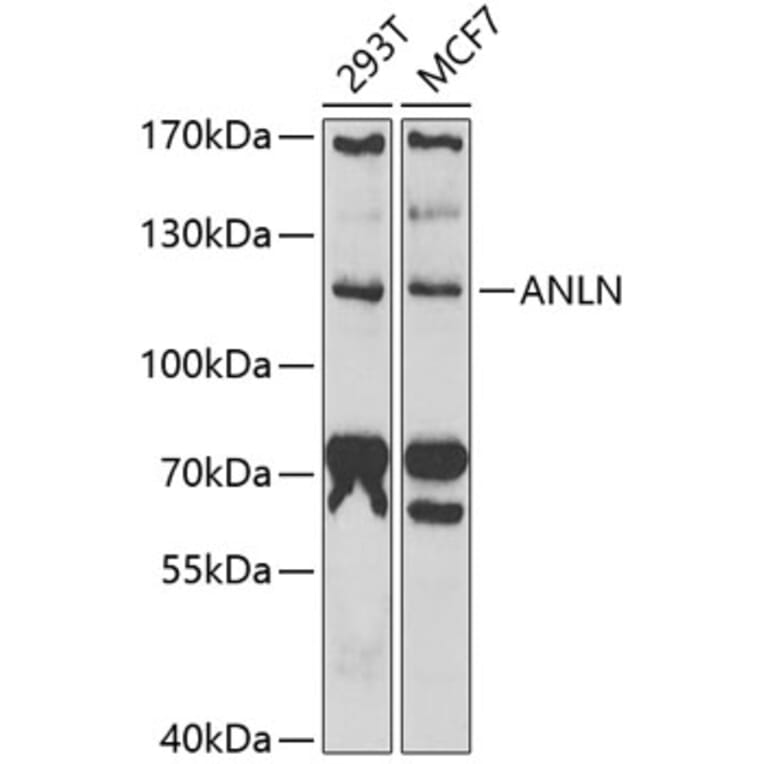 Western Blot - Anti-Anillin Antibody (A9902) - Antibodies.com