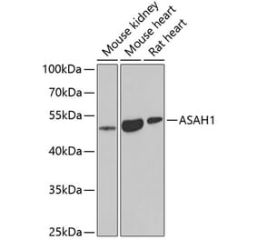 Western Blot - Anti-ASAH1 Antibody (A9903) - Antibodies.com