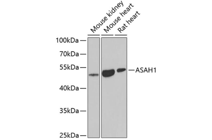 Western Blot - Anti-ASAH1 Antibody (A9903) - Antibodies.com