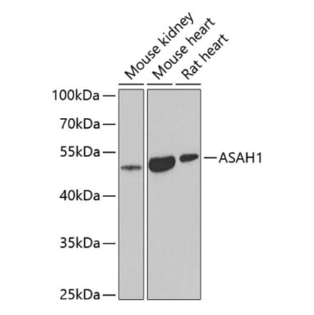 Western Blot - Anti-ASAH1 Antibody (A9903) - Antibodies.com