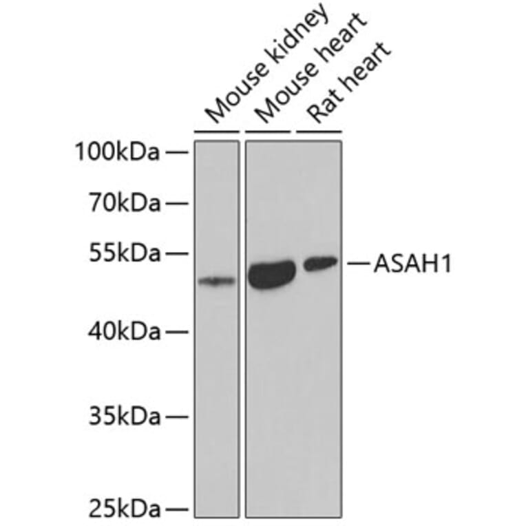 Western Blot - Anti-ASAH1 Antibody (A9903) - Antibodies.com