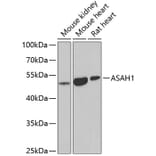 Western Blot - Anti-ASAH1 Antibody (A9903) - Antibodies.com