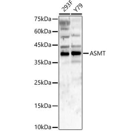 Western Blot - Anti-ASMT Antibody (A9904) - Antibodies.com