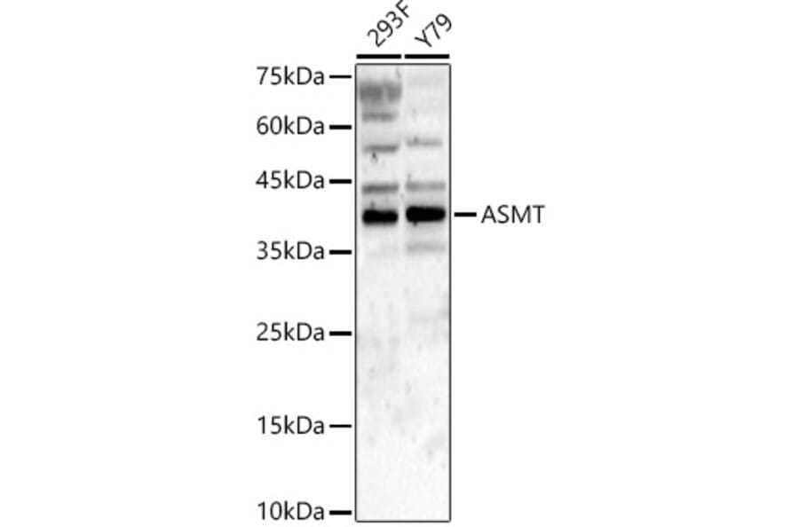Western Blot - Anti-ASMT Antibody (A9904) - Antibodies.com