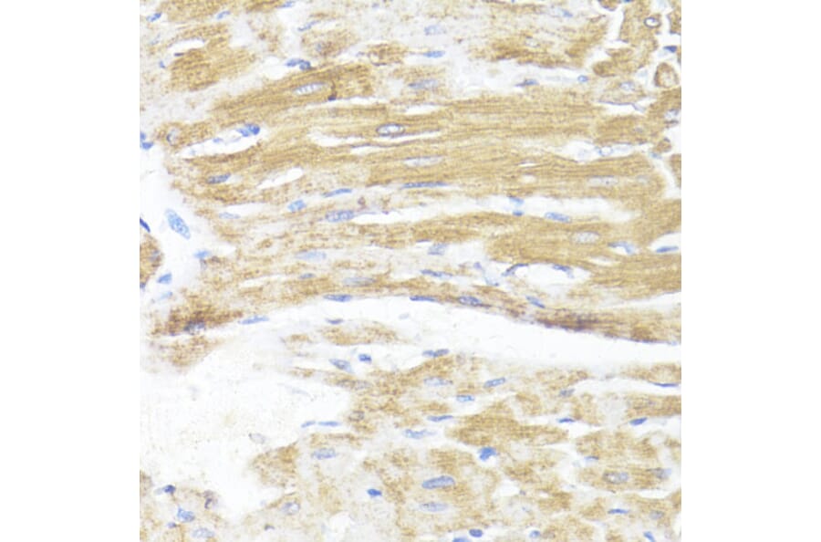 Immunohistochemistry - Anti-ASMT Antibody (A9904) - Antibodies.com