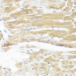Immunohistochemistry - Anti-ASMT Antibody (A9904) - Antibodies.com