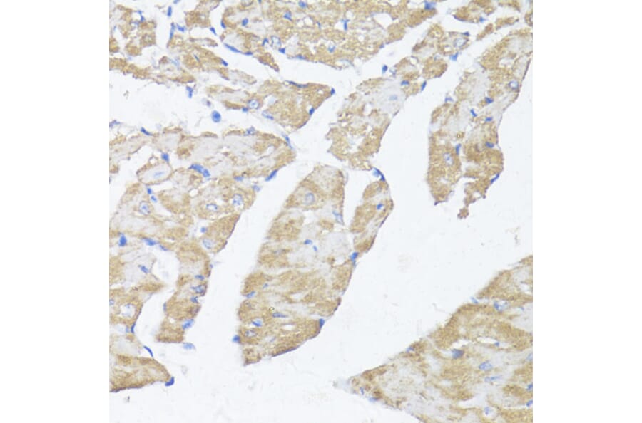 Immunohistochemistry - Anti-ASMT Antibody (A9904) - Antibodies.com