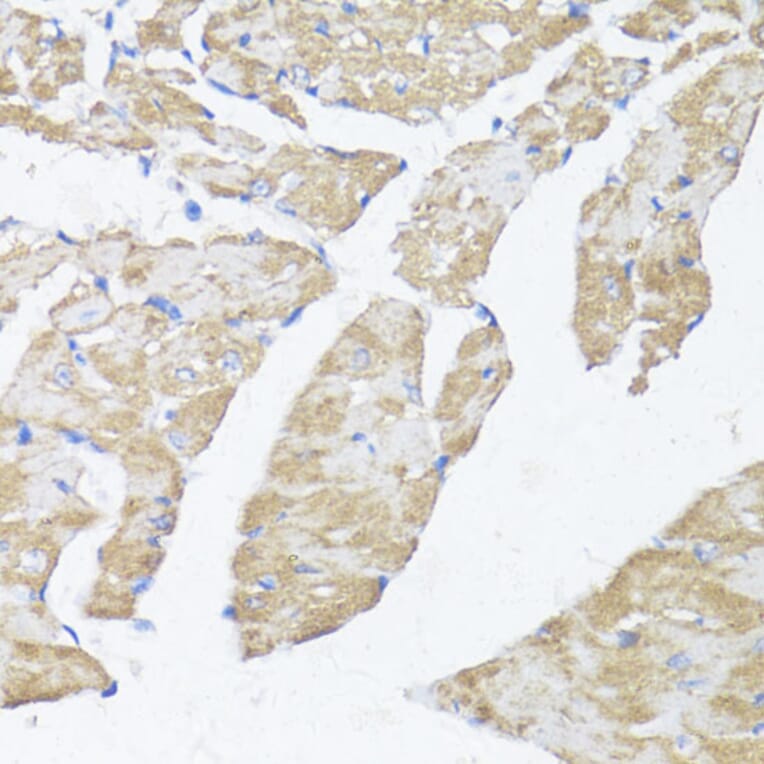 Immunohistochemistry - Anti-ASMT Antibody (A9904) - Antibodies.com
