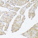 Immunohistochemistry - Anti-ASMT Antibody (A9904) - Antibodies.com