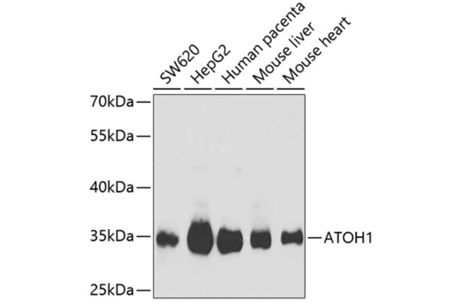 Western Blot - Anti-MATH1/HATH1 Antibody (A9905) - Antibodies.com