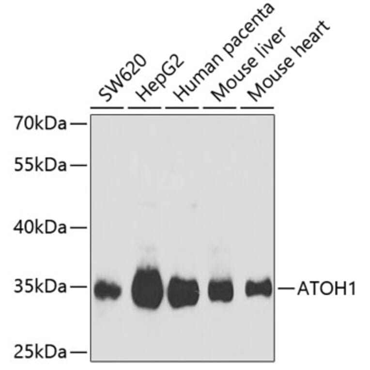 Western Blot - Anti-MATH1/HATH1 Antibody (A9905) - Antibodies.com