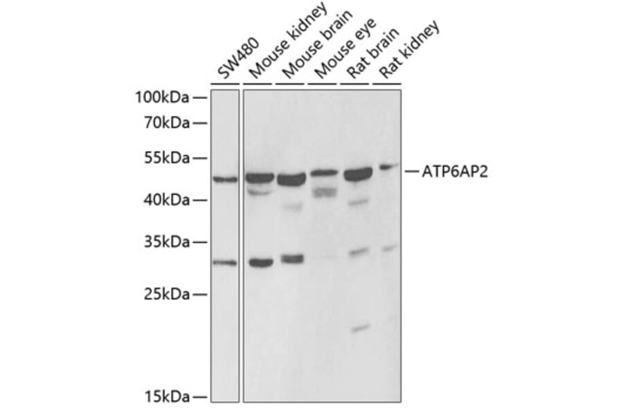 Western Blot - Anti-Renin Receptor Antibody (A9906) - Antibodies.com