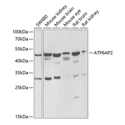 Western Blot - Anti-Renin Receptor Antibody (A9906) - Antibodies.com