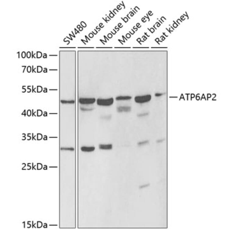 Western Blot - Anti-Renin Receptor Antibody (A9906) - Antibodies.com