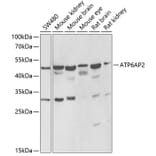 Western Blot - Anti-Renin Receptor Antibody (A9906) - Antibodies.com