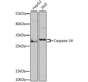Western Blot - Anti-Caspase-14 Antibody (A9907) - Antibodies.com