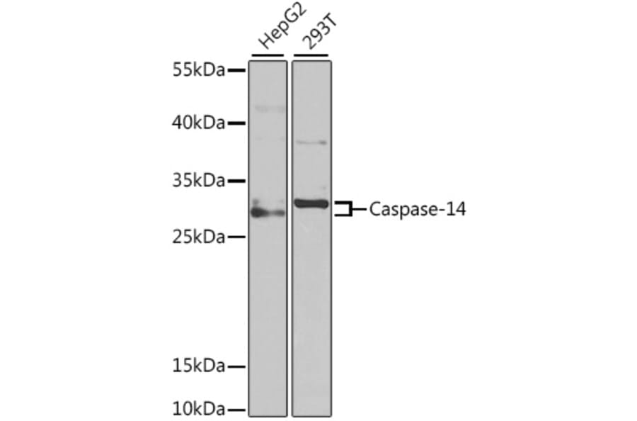 Western Blot - Anti-Caspase-14 Antibody (A9907) - Antibodies.com