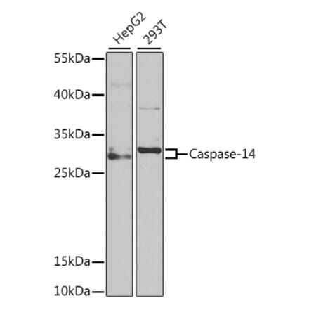 Western Blot - Anti-Caspase-14 Antibody (A9907) - Antibodies.com