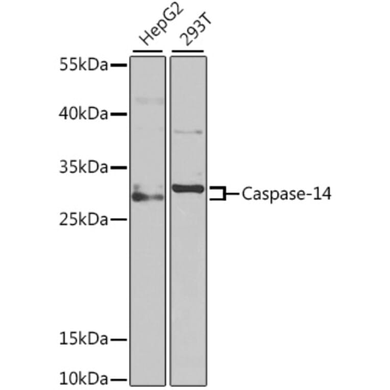 Western Blot - Anti-Caspase-14 Antibody (A9907) - Antibodies.com