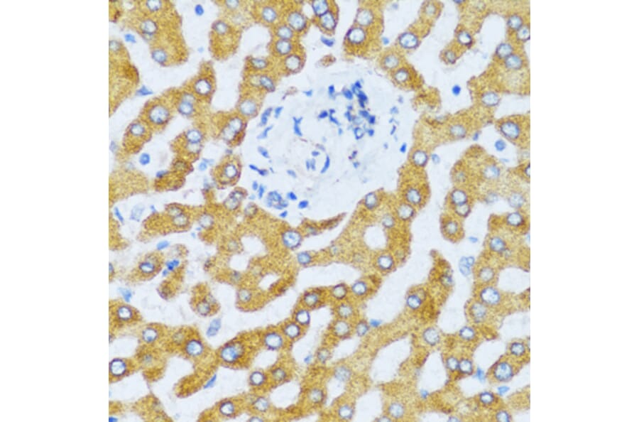 Immunohistochemistry - Anti-CCL25 Antibody (A6543) - Antibodies.com