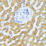 Immunohistochemistry - Anti-CCL25 Antibody (A6543) - Antibodies.com