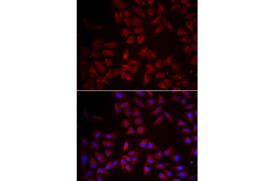 Immunofluorescence - Anti-CCL25 Antibody (A6543) - Antibodies.com