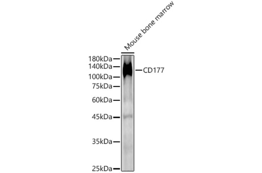 Western Blot - Anti-CD177 Antibody (A9909) - Antibodies.com