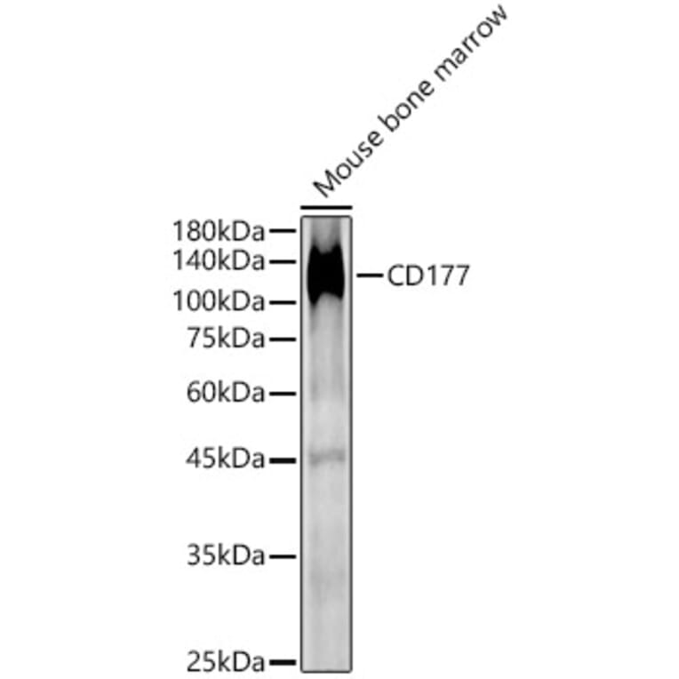 Western Blot - Anti-CD177 Antibody (A9909) - Antibodies.com