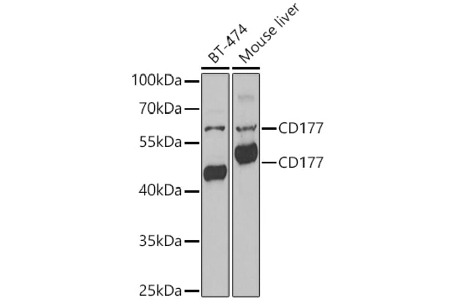 Western Blot - Anti-CD177 Antibody (A9909) - Antibodies.com