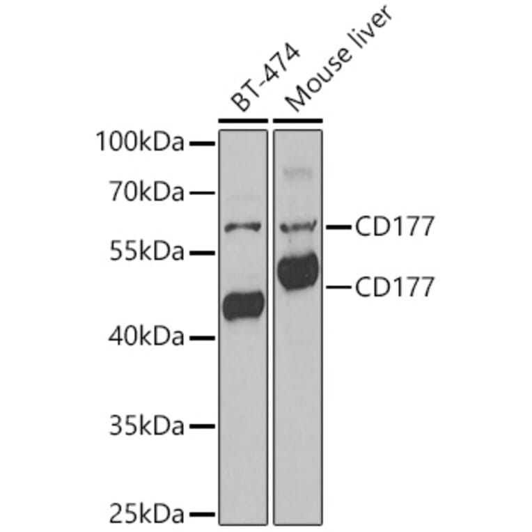 Western Blot - Anti-CD177 Antibody (A9909) - Antibodies.com