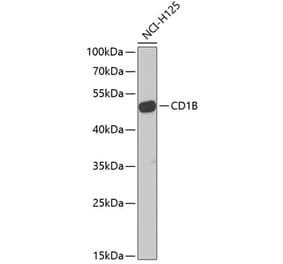 Western Blot - Anti-CD1b Antibody (A9910) - Antibodies.com