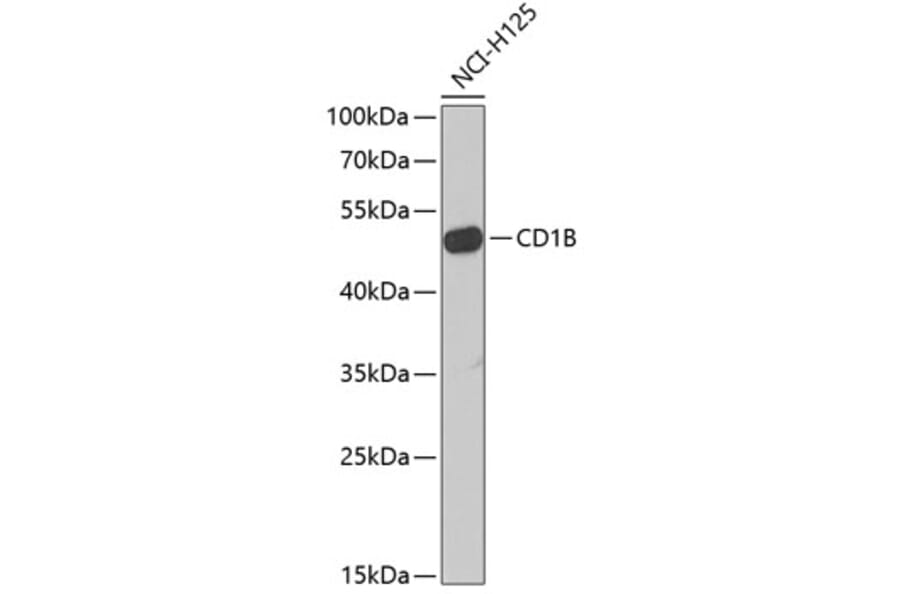 Western Blot - Anti-CD1b Antibody (A9910) - Antibodies.com