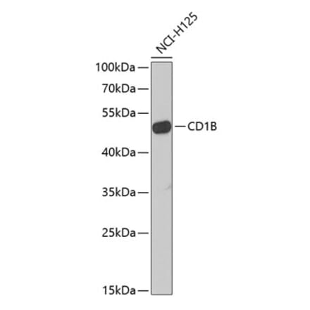 Western Blot - Anti-CD1b Antibody (A9910) - Antibodies.com