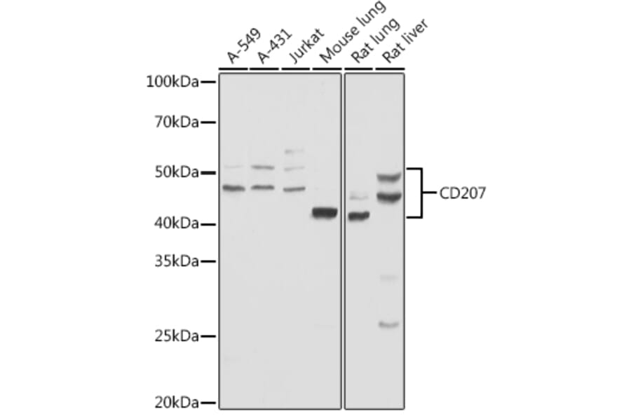 Western Blot - Anti-Langerin Antibody (A9911) - Antibodies.com