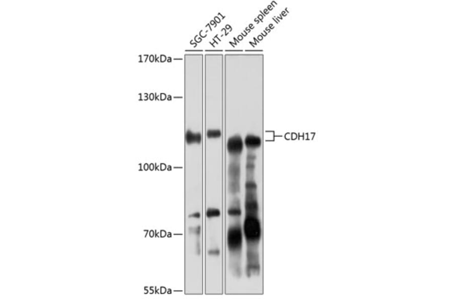 Western Blot - Anti-CDH17 Antibody (A6555) - Antibodies.com
