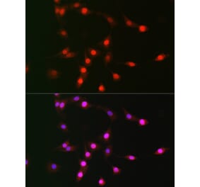 Immunofluorescence - Anti-p19 INK4d Antibody (A9913) - Antibodies.com