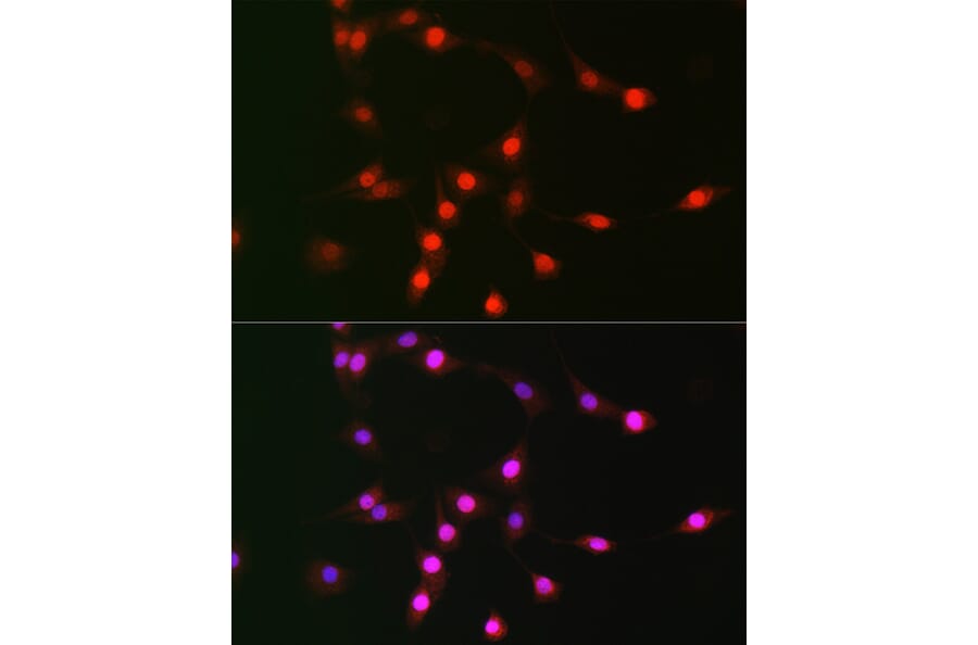 Immunofluorescence - Anti-p19 INK4d Antibody (A9913) - Antibodies.com