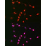 Immunofluorescence - Anti-p19 INK4d Antibody (A9913) - Antibodies.com