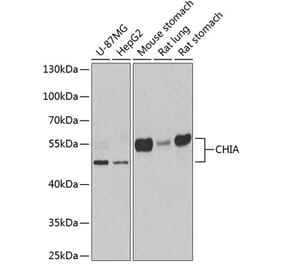 Western Blot - Anti-AMCase Antibody (A9914) - Antibodies.com