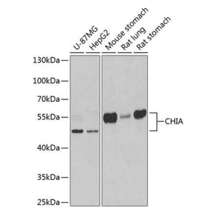 Western Blot - Anti-AMCase Antibody (A9914) - Antibodies.com