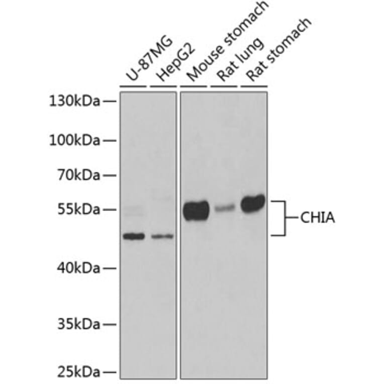 Western Blot - Anti-AMCase Antibody (A9914) - Antibodies.com