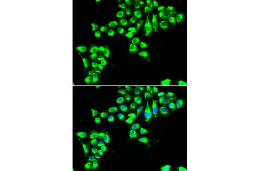 Immunofluorescence - Anti-Claudin 2 Antibody (A9915) - Antibodies.com